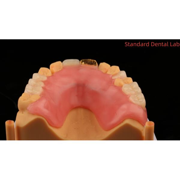 Full Acrylic Dentures With Yellow Gold Teeth/Dental Temporary Acrylic Denture Ivoclar Professional FDA Approved