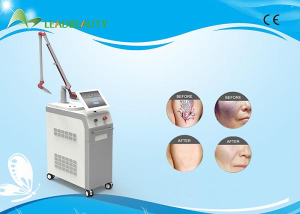 High quality 1064nm / 532nm Q switch nd yag tattoo removal laser machine