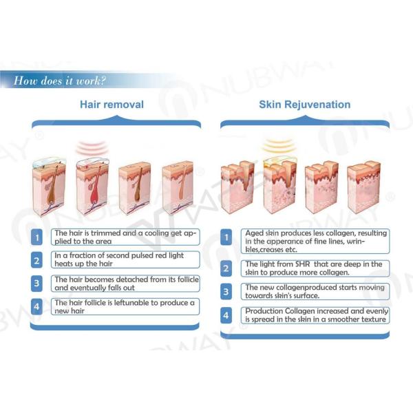 soprano diode laser skin hair removal ipl machine intense pulsed light machine