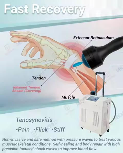 500W Focused Shockwave Therapy Machine for Pain Relief 0.40mj/mm2