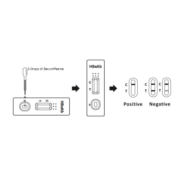 Надежные анализы крови инфекционного заболевания, анализ крови прокладки для бактериальной инфекции
