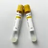 Siny High Quality Medical Consumables Ha & Sodium Citrate & Gel Disposable Vacuum Blood Collection Prp Tube