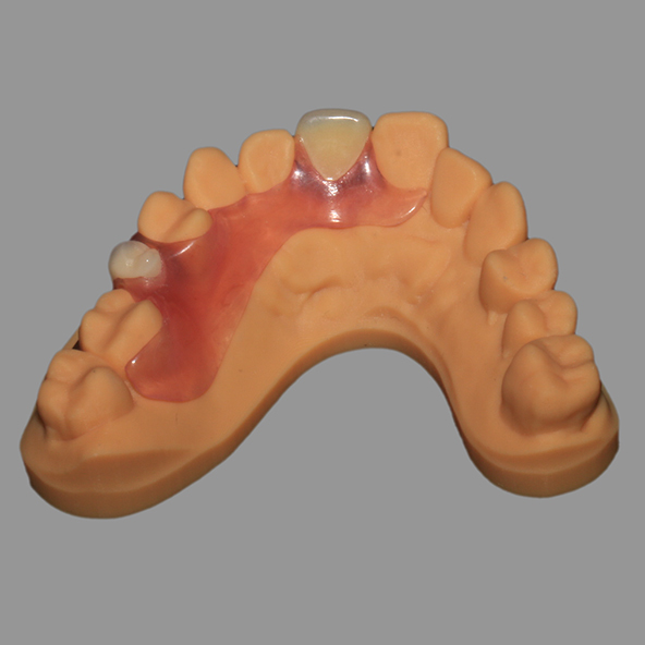 Digital Denture Lab | Natural Looking Valplast Flexible Partial Adjustable Fracture Resistant