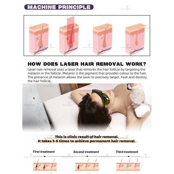3500W Diode Laser Hair Removal Machine With Triple Wavelength And Smartphone Control Display