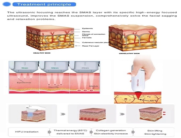4D Hifu Body Slimming Hifu Beauty Machine