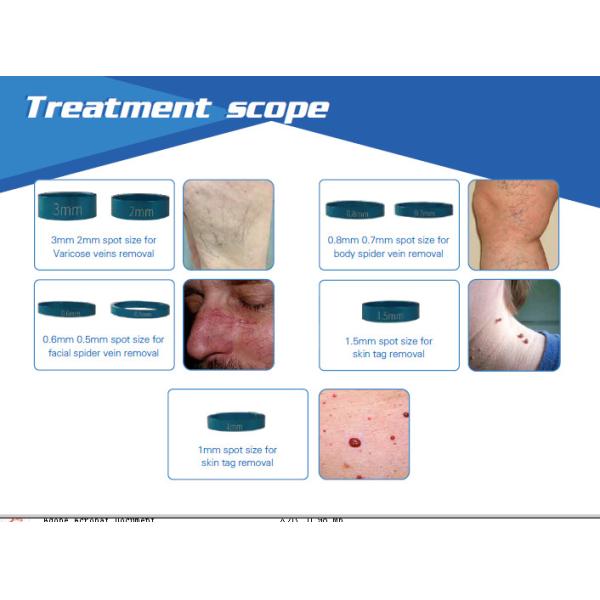 2017 latest 980nm diode laser spider vein/ skin tag removal machine