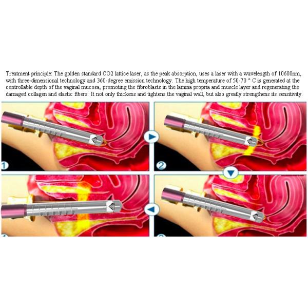 GOMECY 10600 Нм длина волны 7 застегнутые суставные руки Co2 лазерный модуль с OEM ODM сервис лазер для удаления рубцов от прыщей