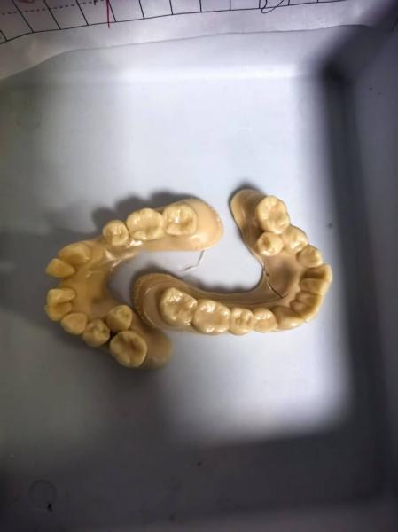 High Temperature 3D Printer Dental Resin Wear-Resistant Non Toxic
