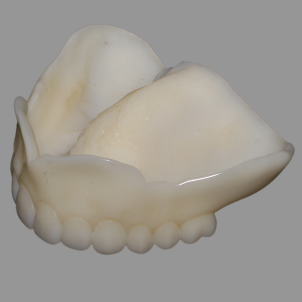 ADL Dental Laboratories | 3D Printed Denture Try in Biocompatible A1/A2/A3 for Perfect Fit And Occlusion