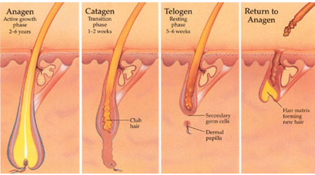 2000w Pain Free Laser Hair Removal Machines Laser Depilation Equipment