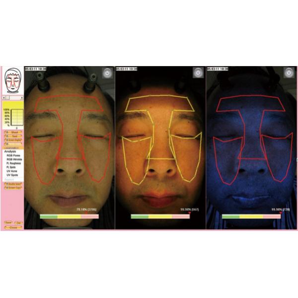 Portable Home / Salon Facial Beauty Skin Analysis Machine With Touch Screen