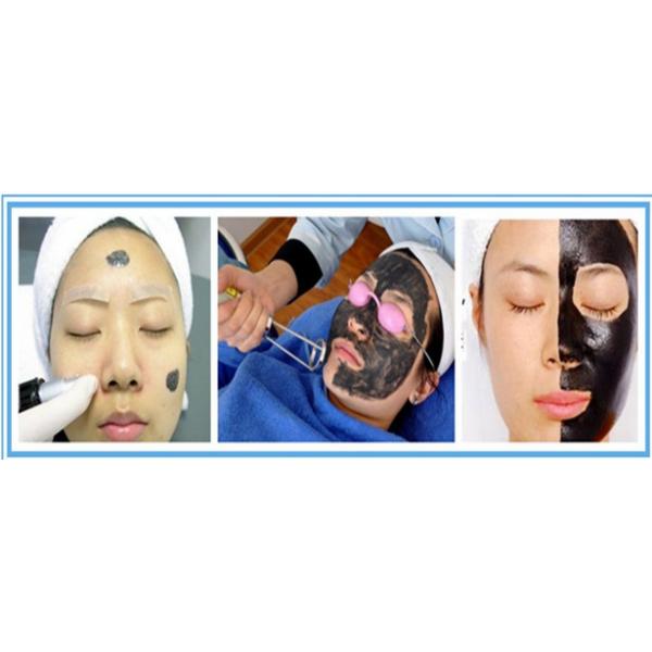 Portable 3 Million Shots Nd Yag Laser Tattoo Removal Machine For Home Use