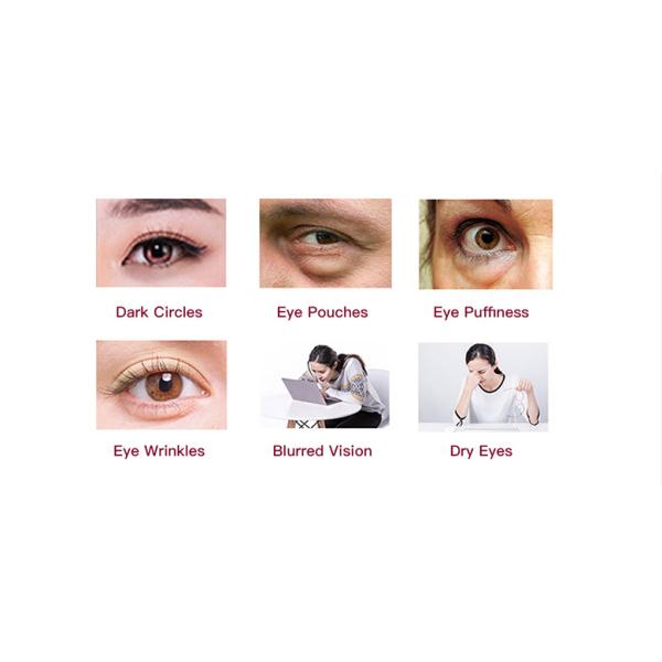 Portable Eyes Beauty Machine Eyes Care Wrinkle Dark Circles Removal Machine