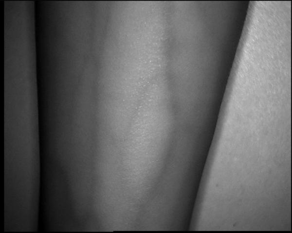 Vascular Images Displaying Veins In Screen Infrared Vein Finder For Nurses And Doctors