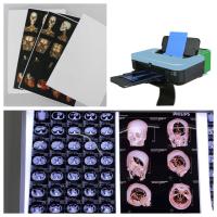 Película de rayos X de inyección de tinta opaca blanca para impresoras Canon/Epson 125/150 micras para resonancia magnética por tomografía computarizada