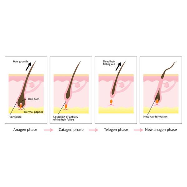 Eliminación de vello Rejuvenecimiento de la piel SHR IPL máquina de belleza 2000W con 2 asas