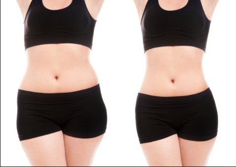 Cryolipolysis slimming equipment ODM&OEM cryolipolysis slimming fat freezing device cryo sculpture machine