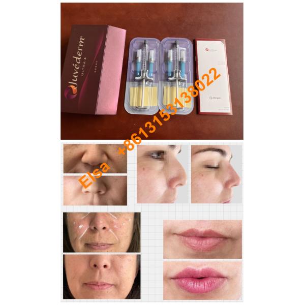 Online Juvederm Ultra3 Ultra4 Voluma Remover Rugas