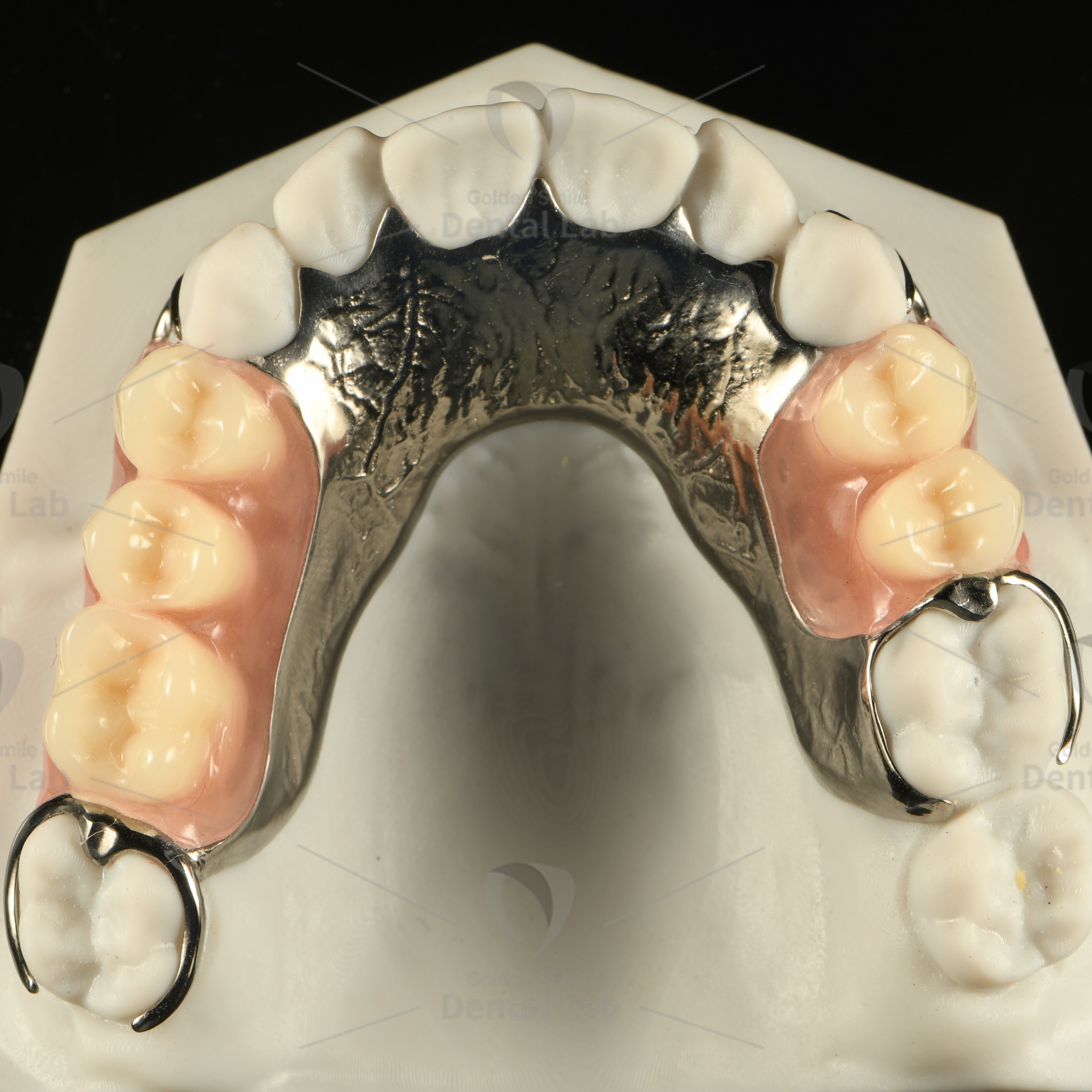 Vitallium Partial Framework