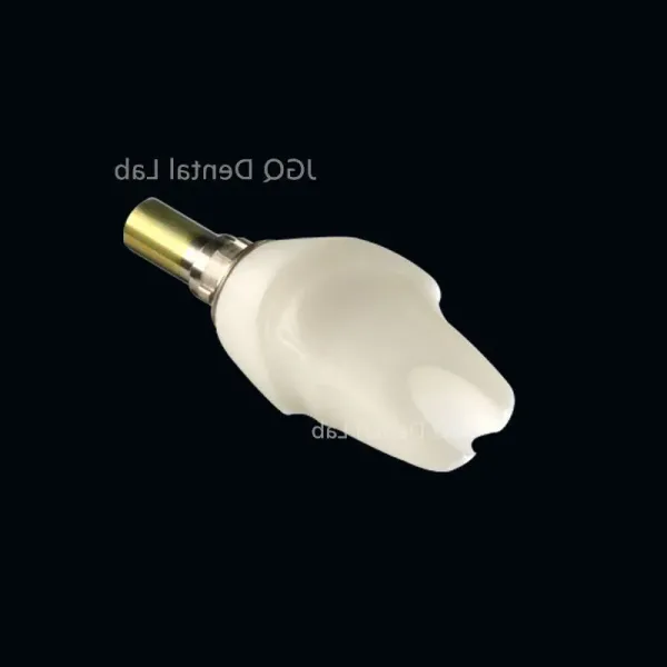 Zirconia Dentures Teeth Dental Lab Single Crown Anterior Posterior Dental Restoration