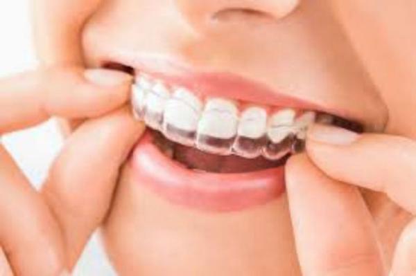 Clear PETG Sheet Teeth Aligners PETG plastic sheet cutting PETG 125mmX0.6 0.75 1mm