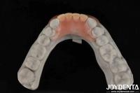 Lleve su práctica dental al siguiente nivel Dentadura flexible con morfología natural y personalización personalizada