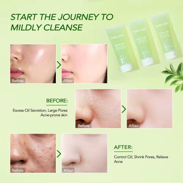 Jelly Face Cleaner Chá Verde Face Wash Aminoácido Gentle Hydropeptide Gel de Limpeza