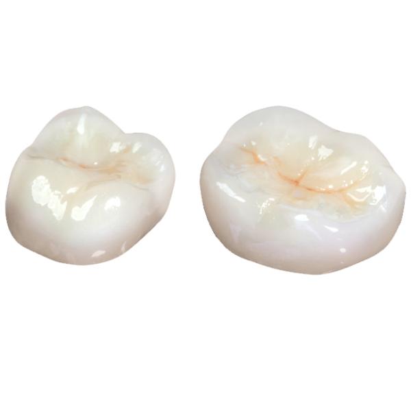 Aesthetically Stable Zirconia Ceramic Crown Non Irritating Implant Crown