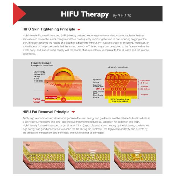 Best price portable hifu anti-aging ultrasound face lift machine korea hifu mini