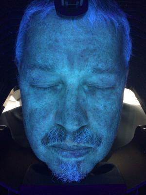 Skin Scanner Diagnosis Machine , 3d Uv Skin Analysis