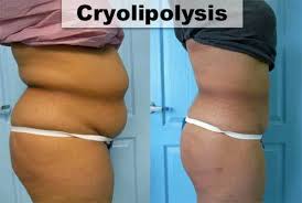 ultrasound cavitation portable Cavitation Slimming Machine for beauty clinic