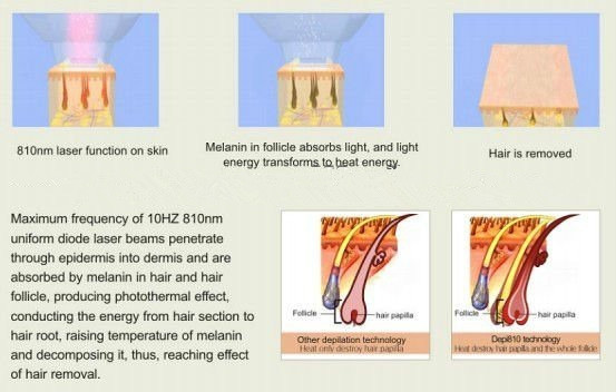 2016 Newest  808 nm diode laser beauty machine for super hair removal
