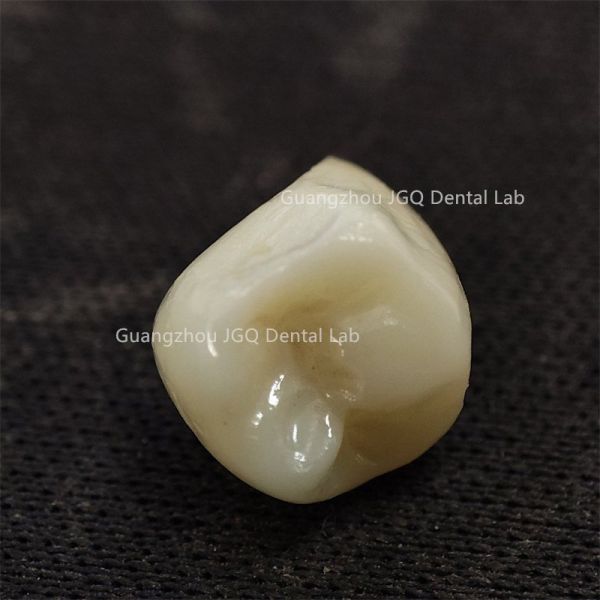 All Ceramic Crown Bridge Dental Laboratory Natural Looking With Aesthetic Effect