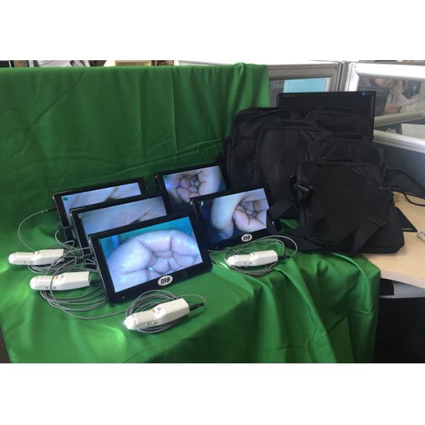 Собственная личность - инструмент осмотра для клиники и больницы электронного Colposcope цифров цервикального рассмотрения применимой индивидуальной