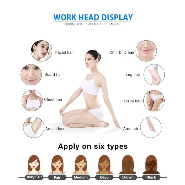 2000MJ q переключило лазер машины 1320nm портативный Picosure лазера Nd YAG