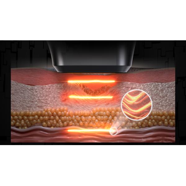 2 Handle Portable 11d Weight Loss Skin Tightenin Hifu Body Slimming Beauty Machine