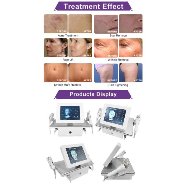 Skin Tightening RF Microneedling Machine