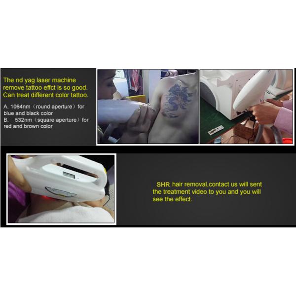 Professional SHR Hair Removal Machine