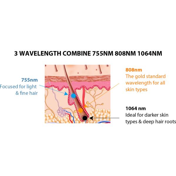 Светлые длины волны машины 3 удаления волос тела лазера волокна ручки