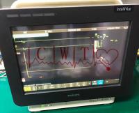 Utilisation d'hôpital de réparation de moniteur patient de RESP NIBP SPO2 Intellivue Mx450