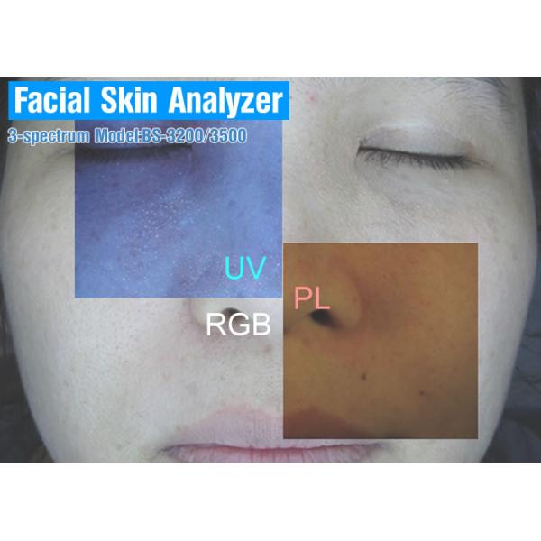 Skin Analyzer Facial Skin Analyzer BS-3200