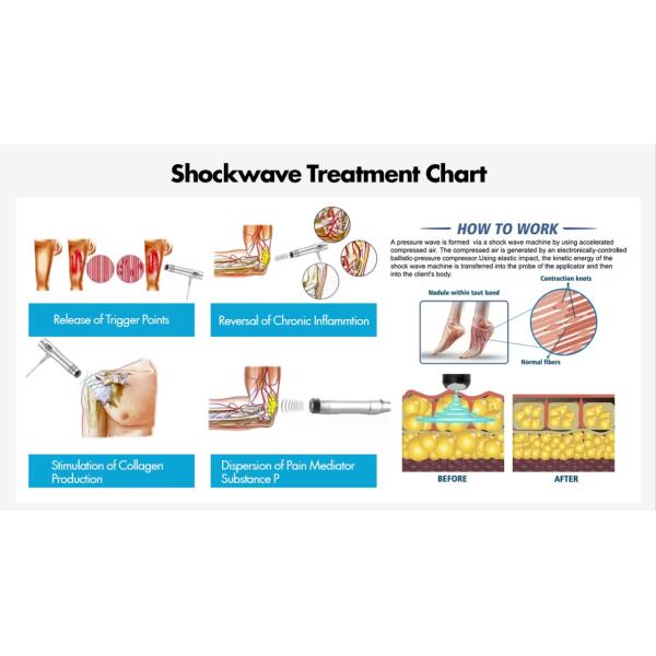 Pain Relief Muscle Bone Tissue Regeneration Treatment Extracorporeal Shockwave Machine