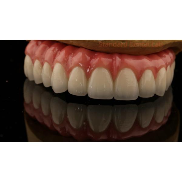 Full Arch Zirconia Implants Bridge Zirconia Crown Vita Shade Customized All On Four / Six Dental Implant