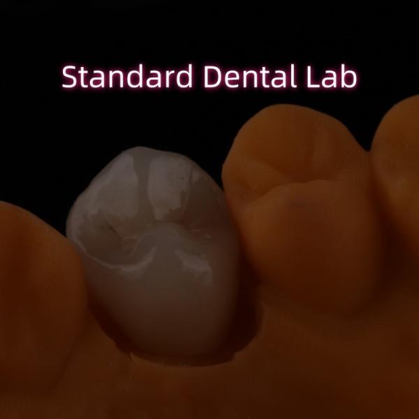 Des dents esthétiques en céramique et en porcelaine