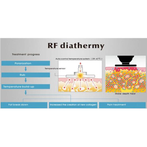 машина терапией 80mm Handdle умная Tecar для боли плеча колена