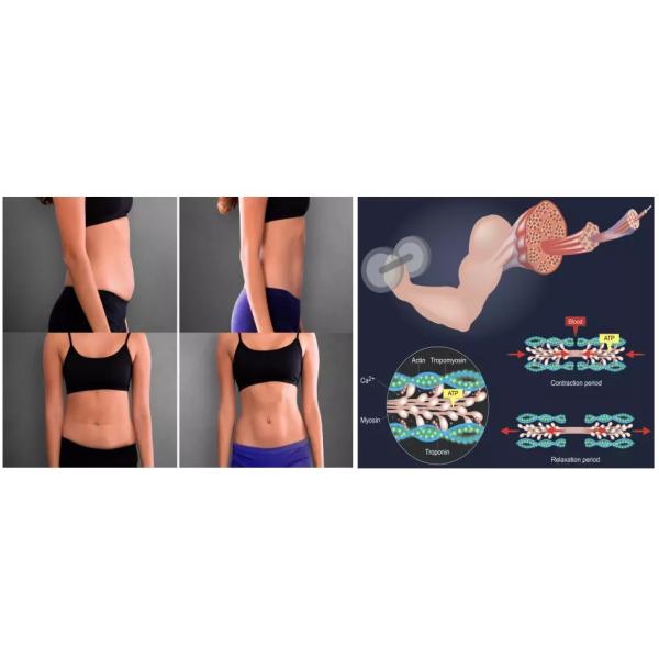 Therapy EMS Electronic Muscle Building Machine Body Sculpting ABS White Color