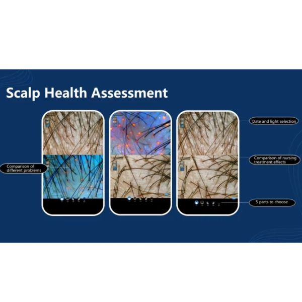 AI System Detection Skin Analyzer With Hair Follicle Detection