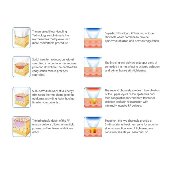 Затягивать кожи частичной радиочастоты микро- Needling
