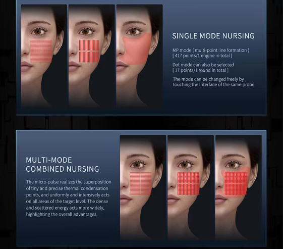 Переносной 22d Max Hifu Machine с Rf Lipo для лифтинга лица и натягивания кожи тела