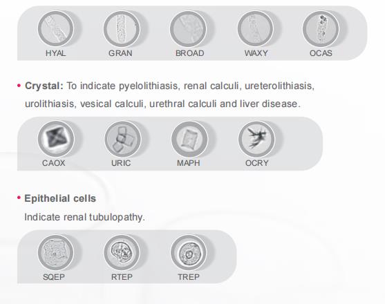 120T/H Automated Urine Analyzer Urinary Sediment Analysis System